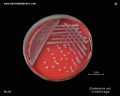 escherichia coli